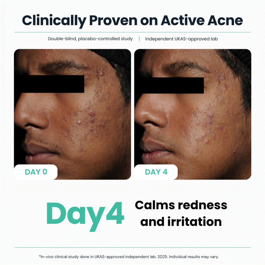 Clinical participant at Day 0 and Day 4