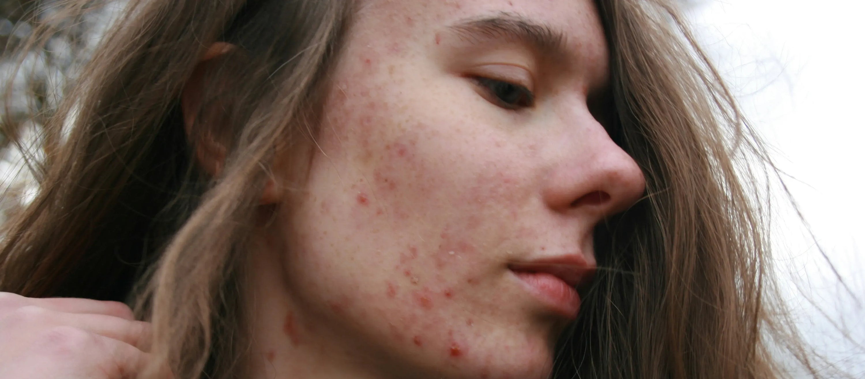 Close-up of ceramide and peptide skincare products highlighting their effectiveness for skin health.