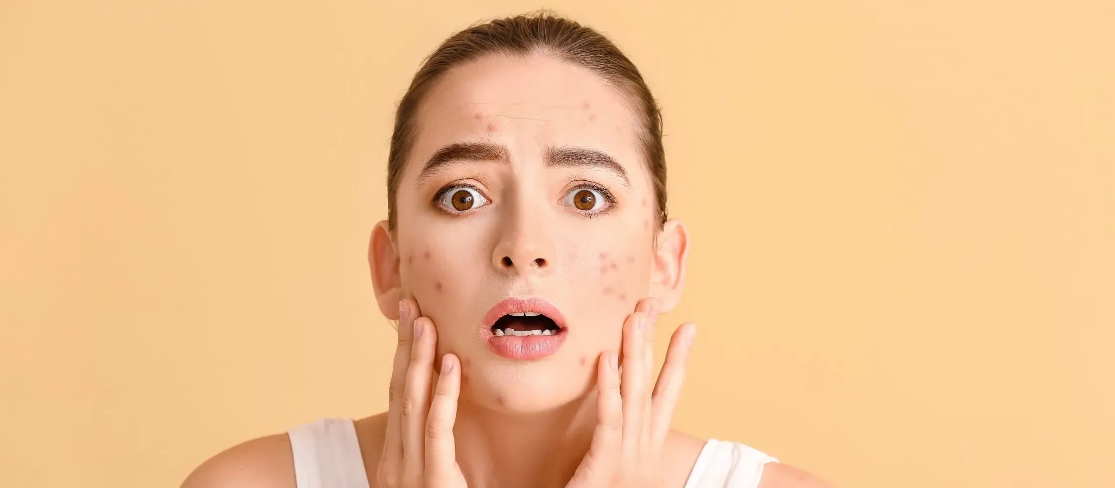 Close-up of a skincare product featuring niacinamide, highlighting its benefits for acne relief and skin clarity.