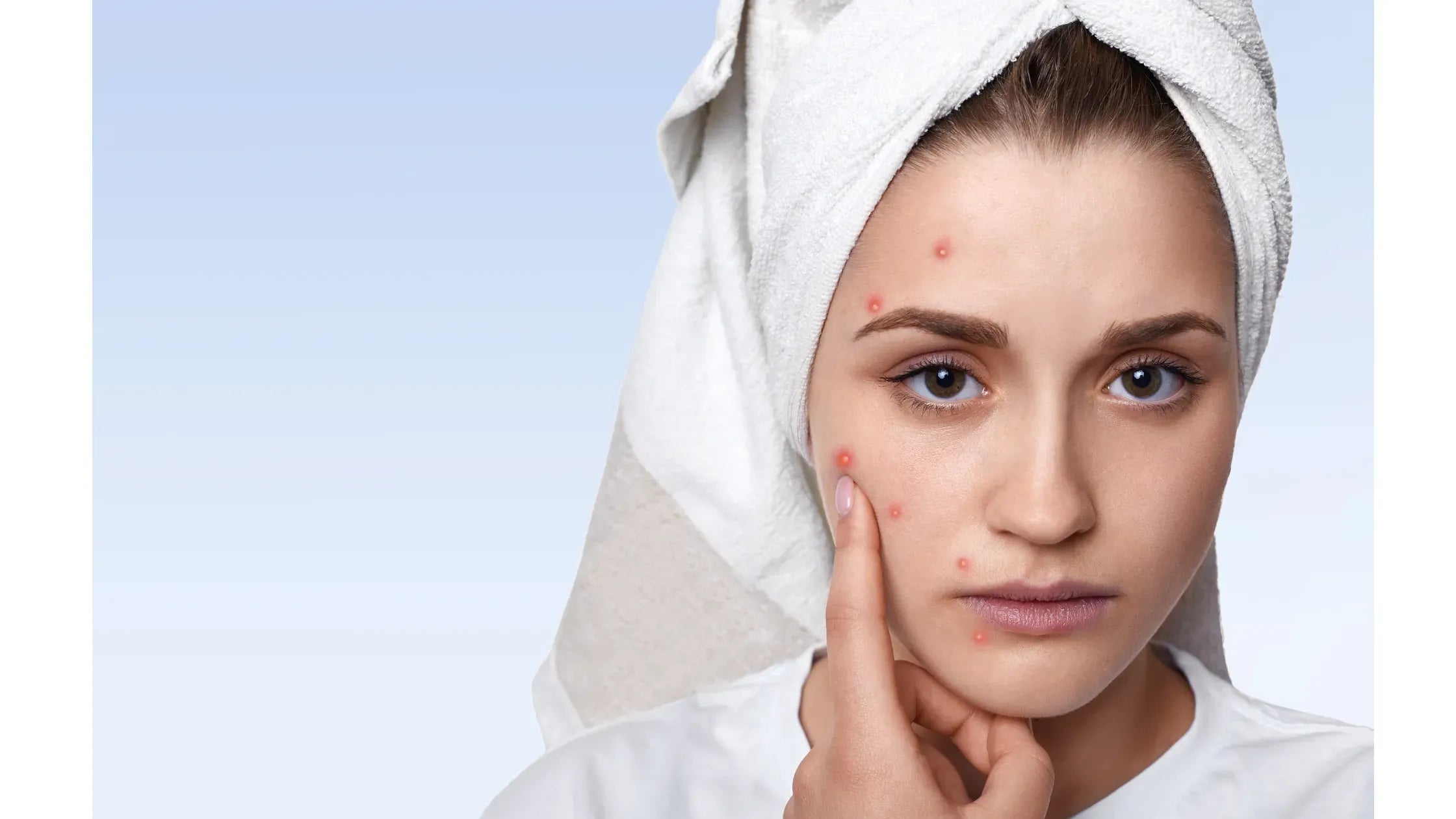 Illustration of skin barrier restoration techniques and ingredients.