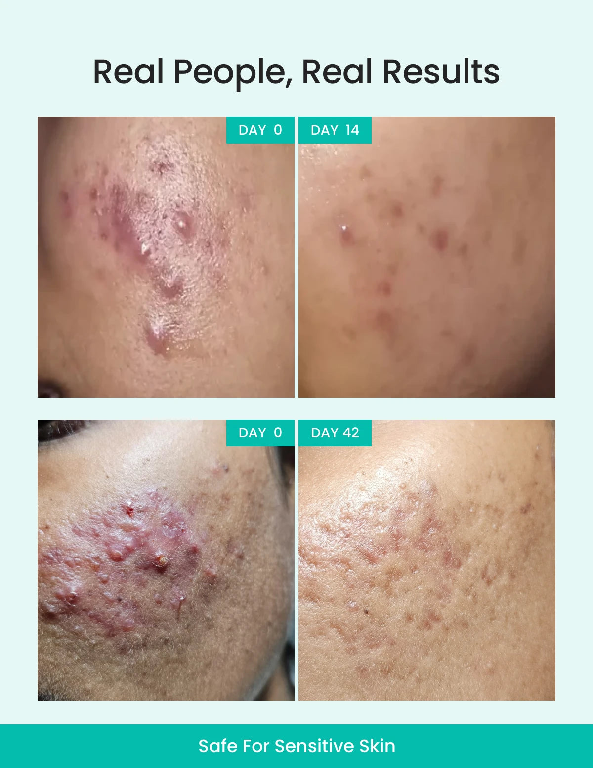 Rapid Clear Facewash