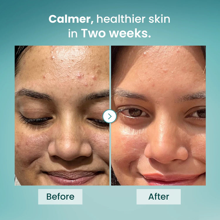 Barrier Repair Gel Moisturiser