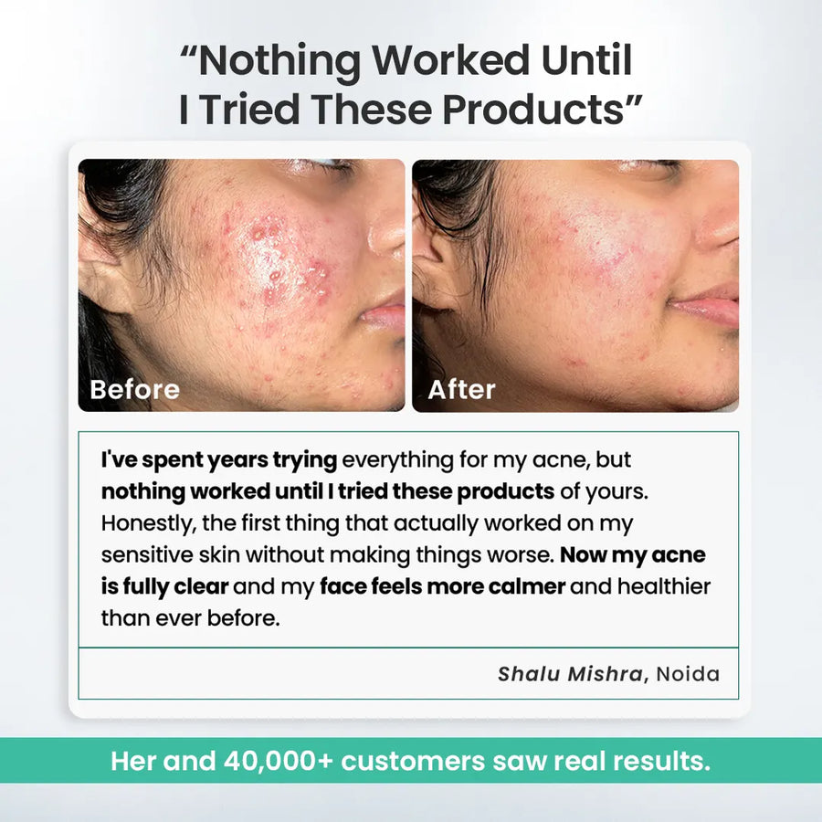 Acne Care Combo Kit