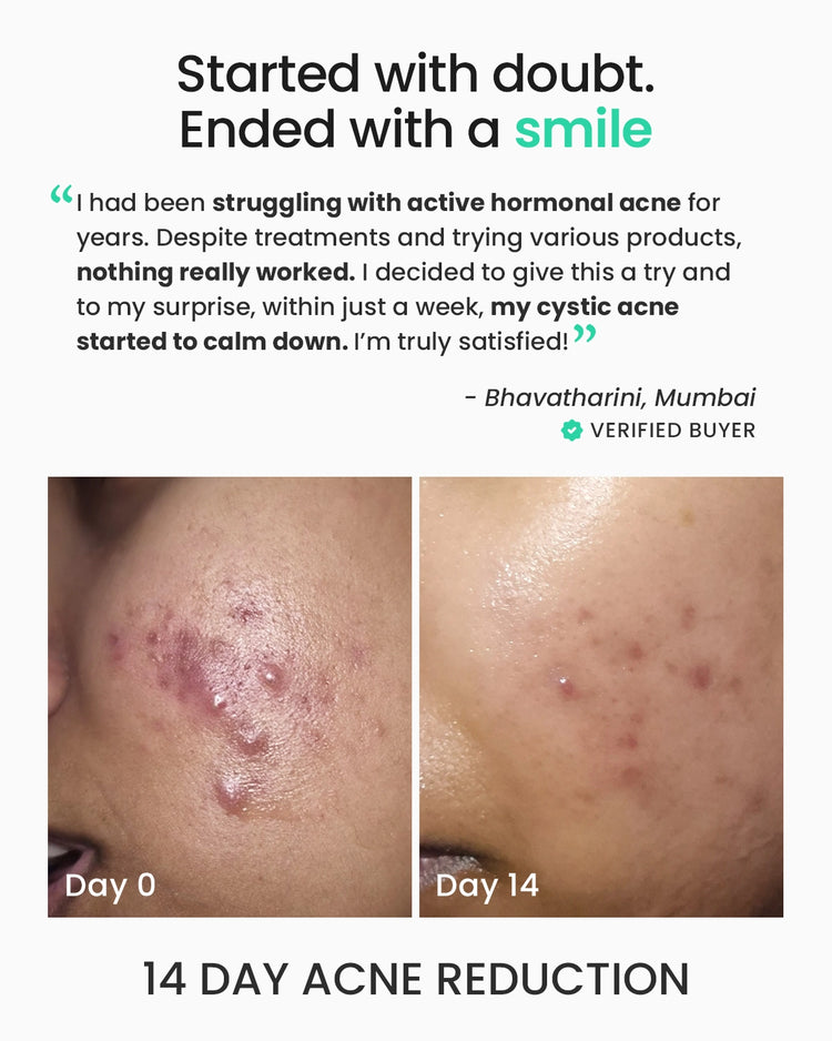 Rapid Clear Facewash