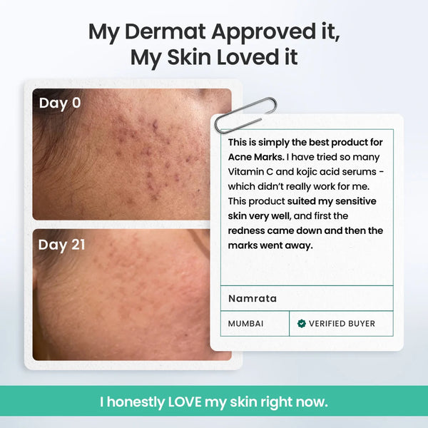 Spot Fade Advanced Repair Serum