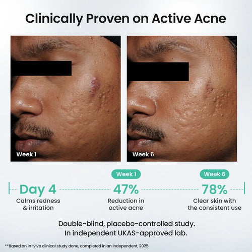 Rapid Clear Facewash
