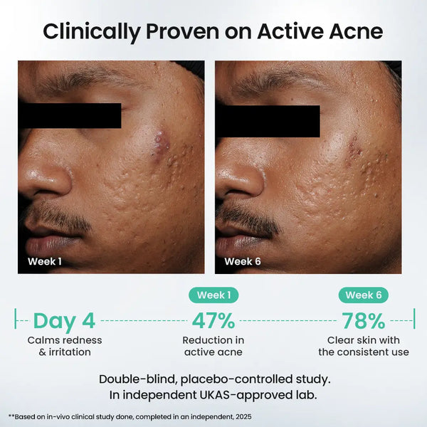 Rapid Clear Facewash