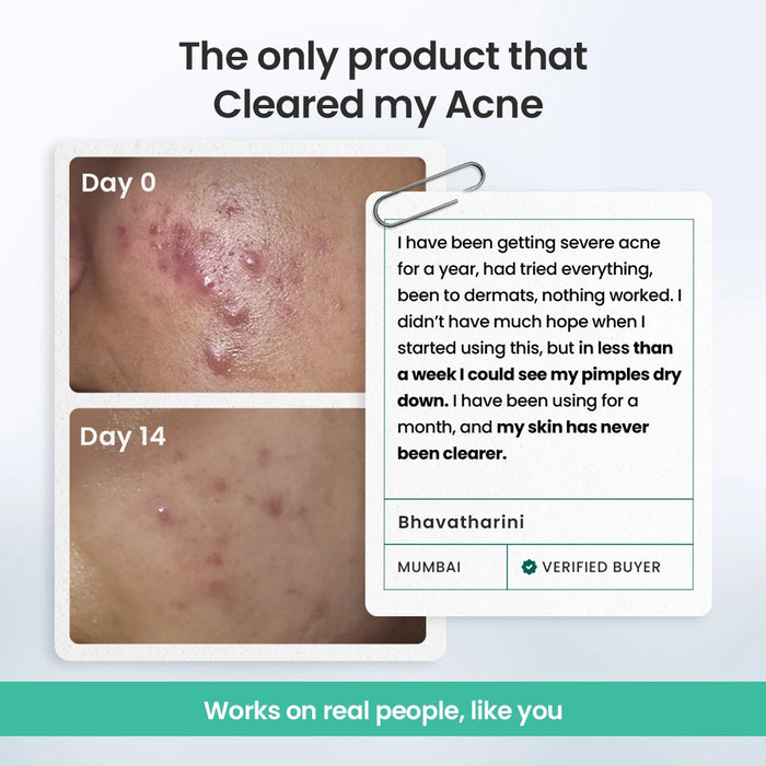 Rapid Clear Facewash