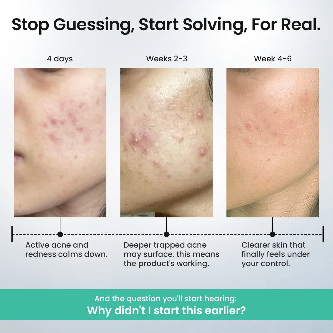 Rapid Clear Facewash