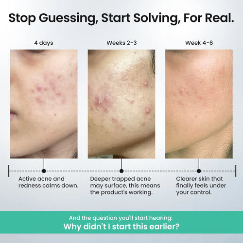 Rapid Clear Facewash