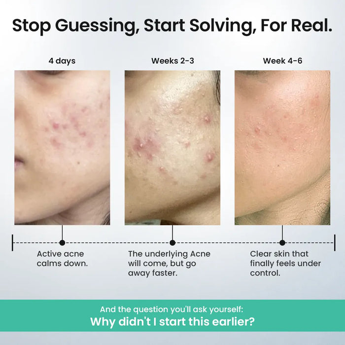 Rapid Clear Facewash
