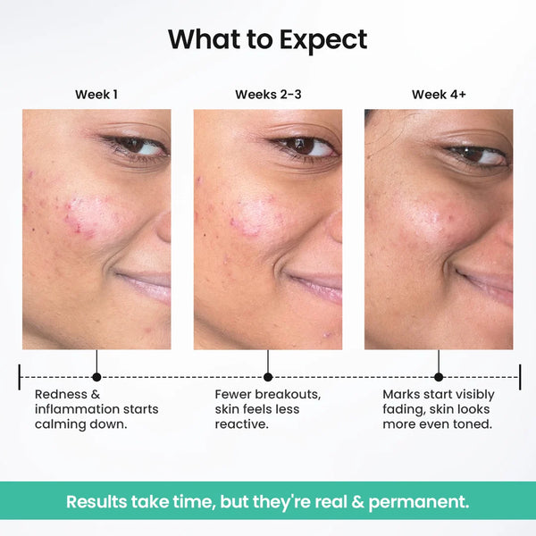 Spot Fade Advanced Repair Serum