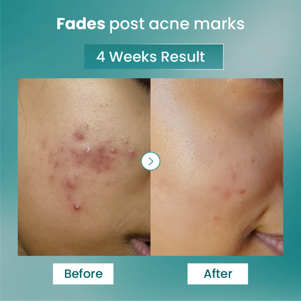 Spot Fade Advanced Repair Serum