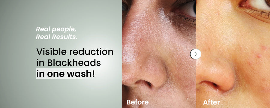 Ultra Smooth Daily Cleanser – The Solved Skin