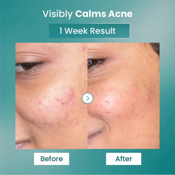 Spot Fade Advanced Repair Serum