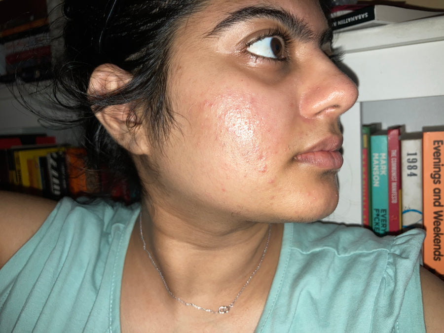 After 6 weeks