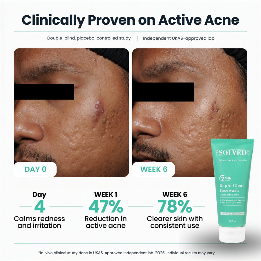 Clinical participant at Day 0 and Week 6