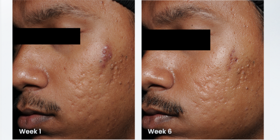Before and after images from the clinical study
