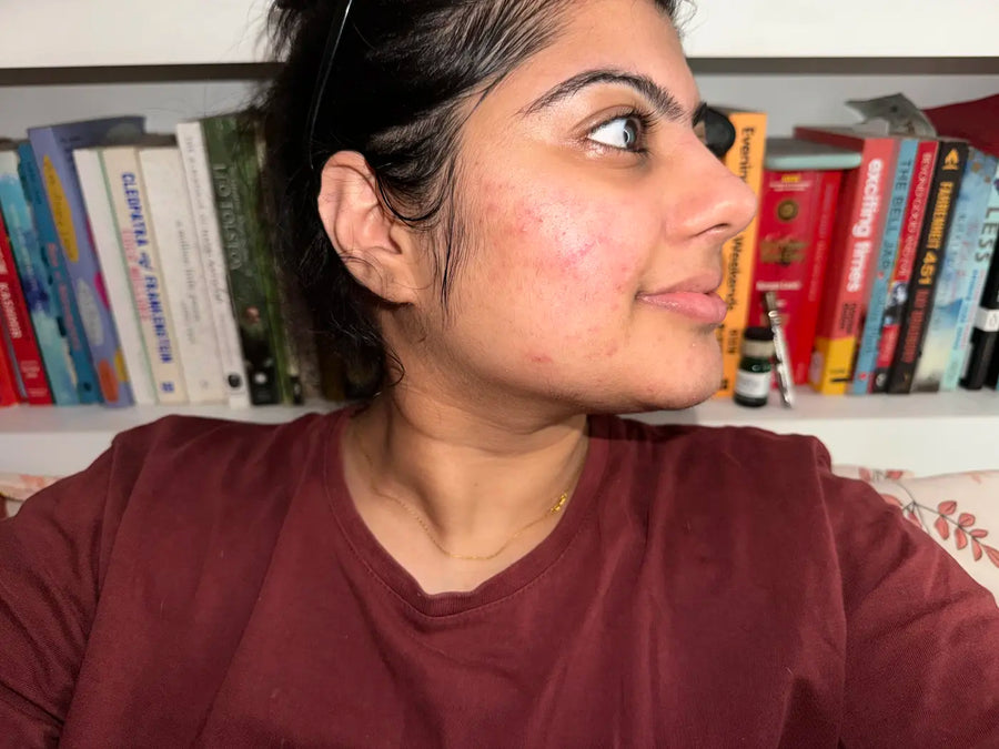 Shalu Mishra after