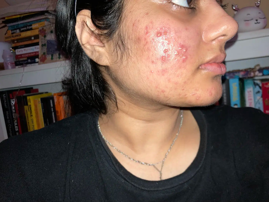Shalu Mishra before