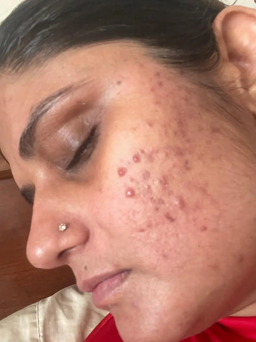Suchita Khaitan before
